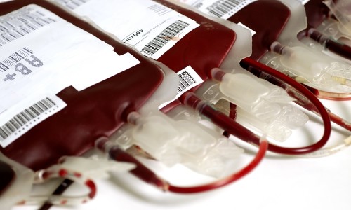 Донорская кровь в банке крови